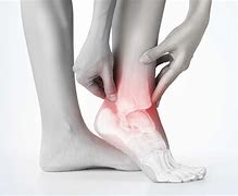 Image result for Foot Injury