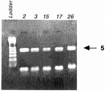 Image result for PCR Exon