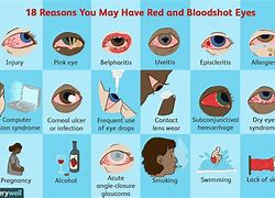 Image result for Red Blurry Eyes