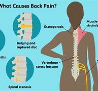 Image result for Lower Left Back Pain