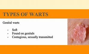 Image result for Genital Warts vs Fordyce Spots