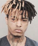 Image result for Xxxtentacion Hair Growth