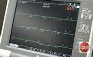 Image result for Apple Watch Atrial Fibrillation