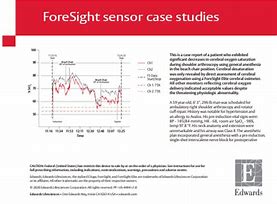 Image result for Afon Sensor