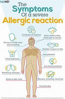 Image result for Allergic Reaction Signs