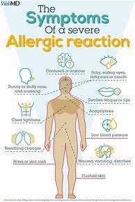 Image result for Antibiotic Allergic Reaction
