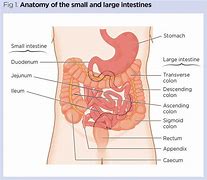 Image result for tapered ileum