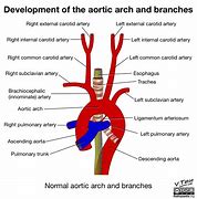Image result for aotiric�n