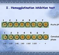 Image result for Hemagglutination Inhibition Assay