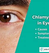 Image result for Chlamydia Trachomatis Eyes