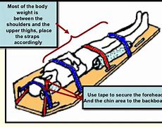 Image result for Spine Board Parts