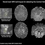 Image result for Brain Neuron Scan