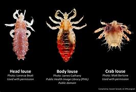 Image result for Crabs vs Lice