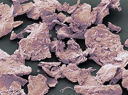 Image result for Eczema Skin Flake Under Microscope