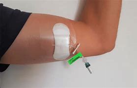 Image result for Midline Catheter Sign Hang Tag