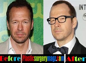Image result for Donnie Wahlberg Teeth