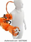 Image result for Cyborg Arm Implant