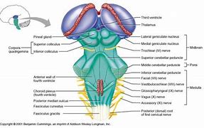 Image result for Colliculus Facialis