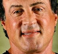 Image result for Famous People with Bell's Palsy