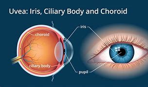 Image result for Retina Iris