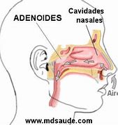 Image result for asenoides