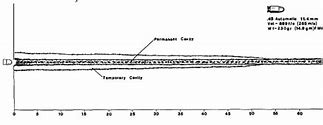 Image result for Wound Profiles