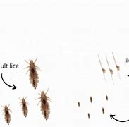 Image result for Lash Lice