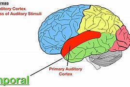 Image result for Auditory Compleex Brain