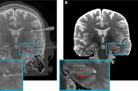 Image result for False Memory Implantation