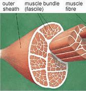 Image result for Muscle Tear Location