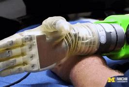 Image result for Robotic Hand Prosthetic