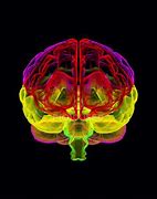 Image result for Big Human Brain