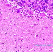 Image result for Brain Tissue Microscope