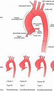 Image result for How Big Is 2 Cm Dilated