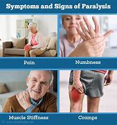 Image result for Paralysis Symptoms