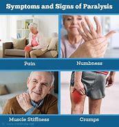 Image result for Paralysis Attack