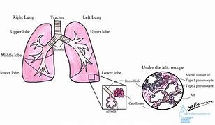Image result for Lung Cancer Cell Diagram