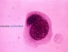 Image result for Chlamydia Inclusion Body
