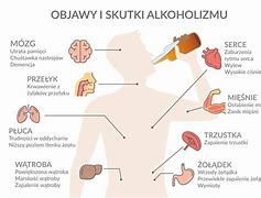 Image result for choroba_alkoholowa