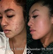 Image result for Skin and Carnivore