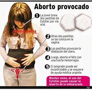 Image result for abortibo