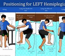 Image result for Arm in a Recovery Position