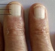 Image result for Terry's Nails