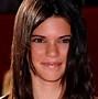 Image result for Kendall Jenner Eye Surgery