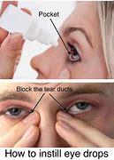 Image result for eyes drop