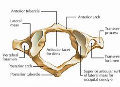 Image result for Atlas Bone Anatomy