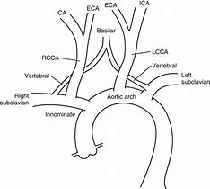 Image result for Carotid Ultrasound