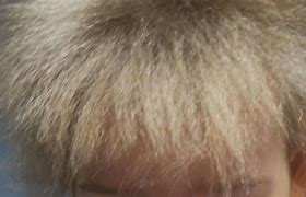 Image result for Scalp Color