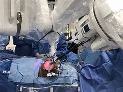 Image result for Robotic Kidney Surgery
