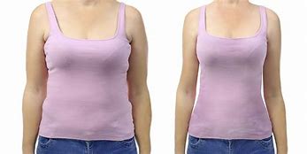 Image result for Lose Weight Surgery